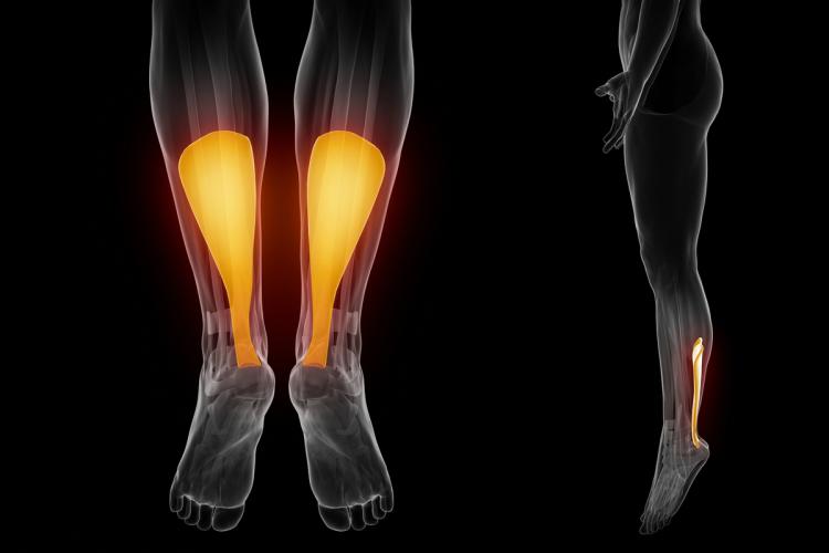 Achilles tendon clearance and knee pain